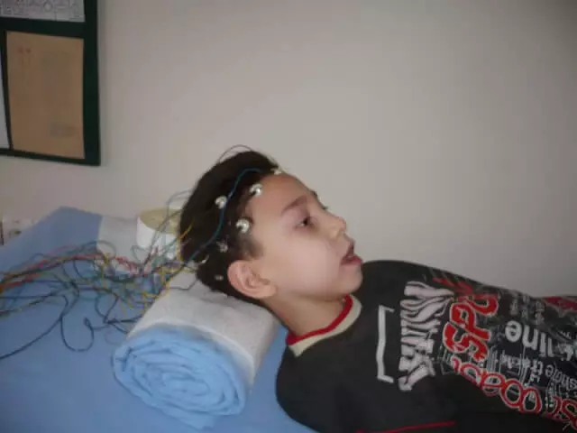 Resim 3: EEG (Elektroensefalografi) çekiminden bir kare 